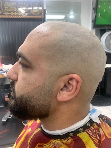 A smooth head shave with a lined-up beard